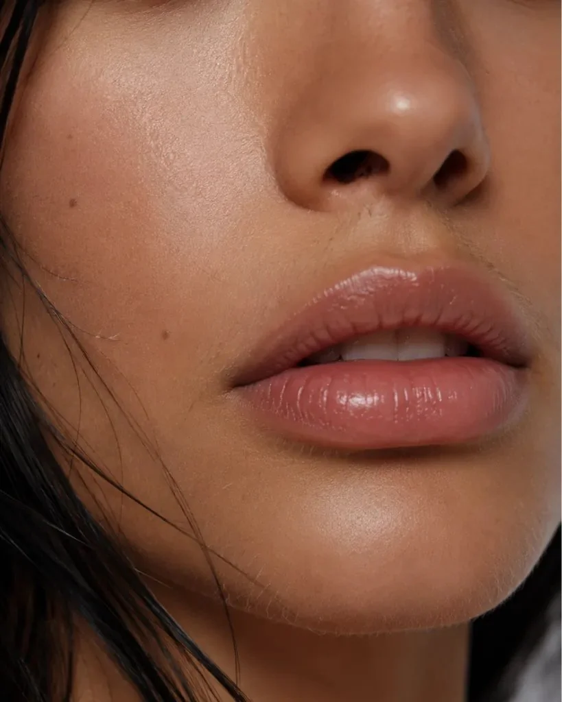 Hyaluronsäure Coburg - Hyaluron Filler bei med.aesthetic