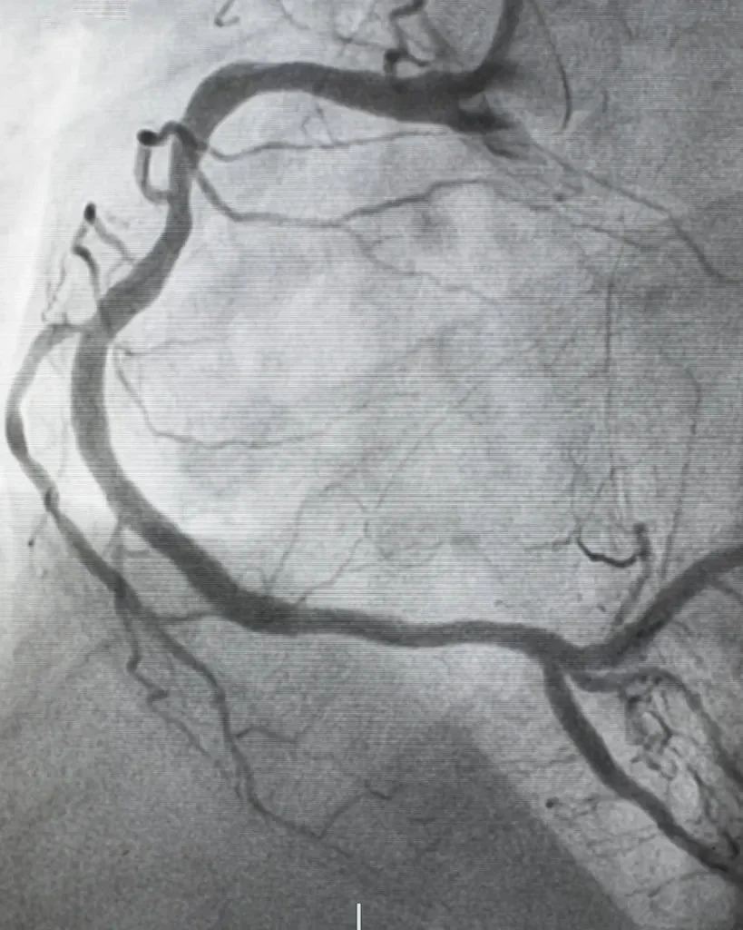 Arterien-Duplex Coburg - ABI-Messung bei med.aesthetic